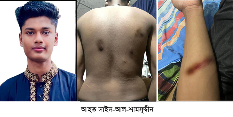 ফেঞ্চুগঞ্জের ফরিদপুরে যুবকের উপর আওয়ামী সন্ত্রাসীদের হামলা