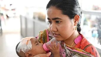 সিলেটে হামের উপসর্গে আরও ২ শিশুর মৃত্যু